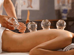 Five facts you need to know about Cupping Therapy