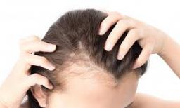 What causes hair loss?