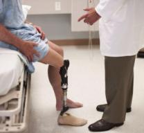 How Custom Orthotics and Prosthetics Improve Mobility and Quality of Life