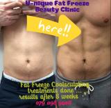 Fat Freeze Coolsculpting treatments Kempton Park CBD Beauty 3 _small