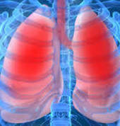 Lung conditions