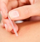 chiropractic Dry needling