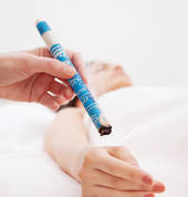 Moxibustion