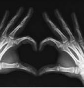 Drs.Else and Robertson Chiropractors Sandton CBD Family Wellness Chiropractics 1_small