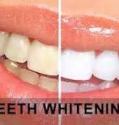 Pure Smile Teeth Whitening