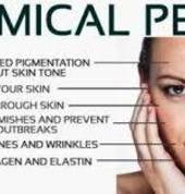 Chemical Skin Peelings & AHA Clinical Facials