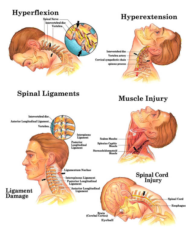 Dr D Griesel - Linden Chiropractic - Sports Injury Chiropractors ...