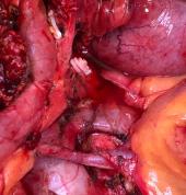 Dr Graham Stapleton Foreshore Specialist Surgeons 1_small