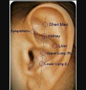 Be Free Detoxing Table View Acupuncture 2_small