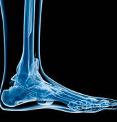 David Ives Podiatrist Randpark Ridge Rehabilitation Podiatrists 4_small