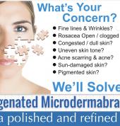 Microdermabrasion with Oxygen Infusion