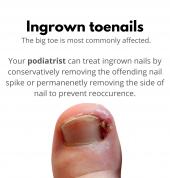 Cape Podiatry Paarl Medicentre Southern Paarl Sports Injury Podiatrists 1_small