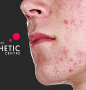 The Melrose Aesthetic Centre Melrose Anaesthesiologists 1_small