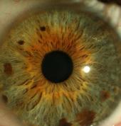 Dr, Frank Scott George Central Iridology 1_small