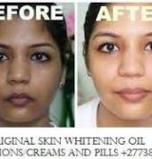 Permanent Skin Lightening Skin Whitening Products Reiger Park Skincare Products 3_small