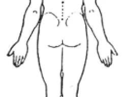 Neck Pain