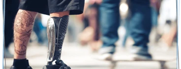 All prosthesis is especially made according to each patient’s needs and specifications.