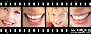 Myteeth Table View 1