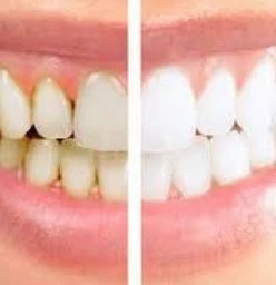 Mangisa Family Dental Care Berea 1